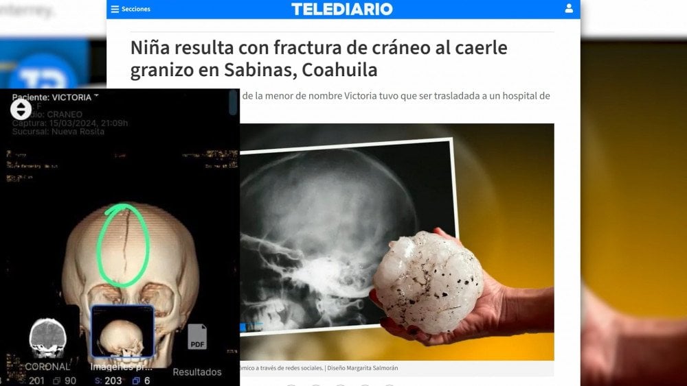 Hail Injuries in Mexico, Large Hail in Mexico